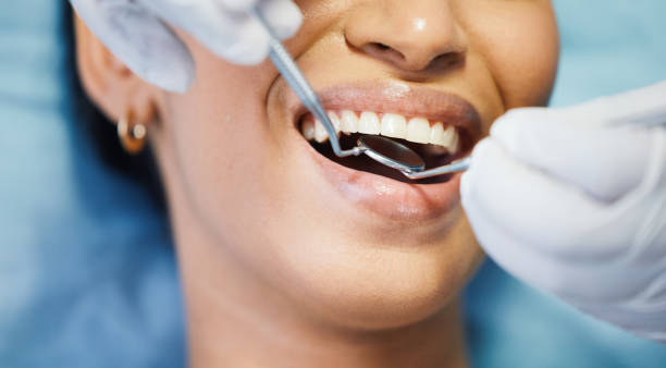 Best Emergency Root Canal Treatment in Bonduel, WI