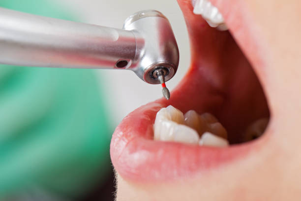 Best Emergency Dental Care for Broken or Chipped Teeth in Bonduel, WI